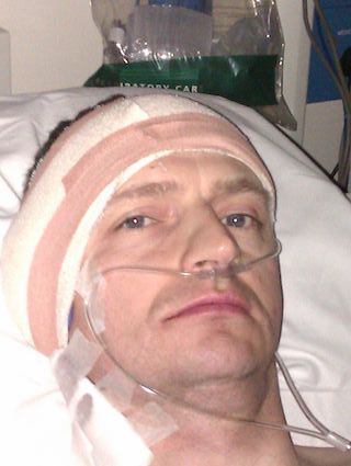 Recovering from surgery